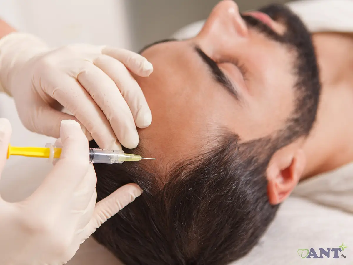 تقویت رشد مو با مزوتراپی